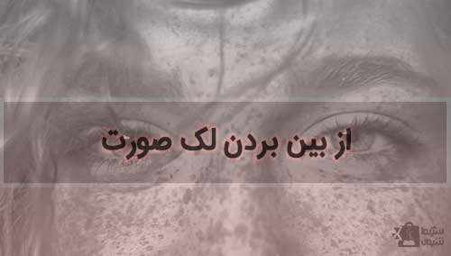 از بین بردن لک صورت
